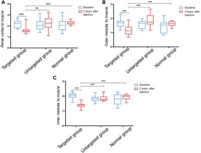The Feasibility of Targeted Magnetic Iron Oxide Nanoagent for Noninvasive <mark class="highlighted">IgA Nephropathy</mark> Diagnosis